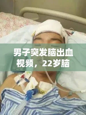 男子突发脑出血视频，22岁脑出血视频 