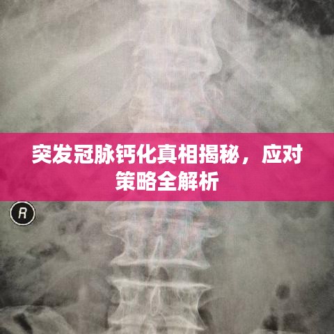 突发冠脉钙化真相揭秘，应对策略全解析