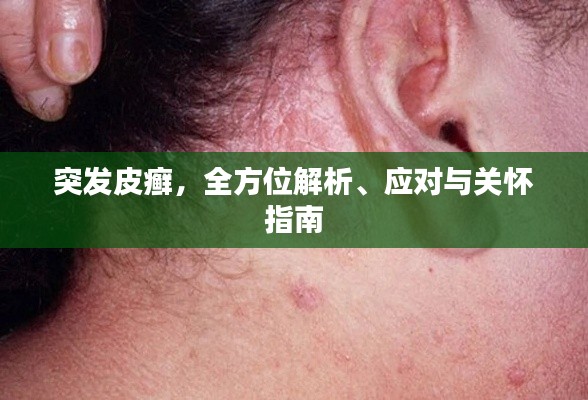 突发皮癣，全方位解析、应对与关怀指南