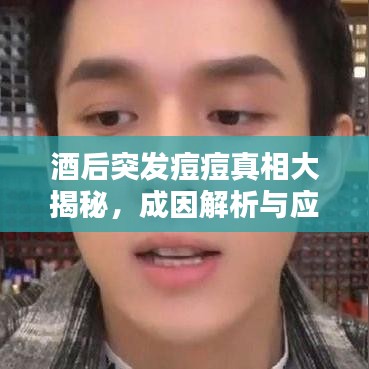 酒后突发痘痘真相大揭秘，成因解析与应对之策