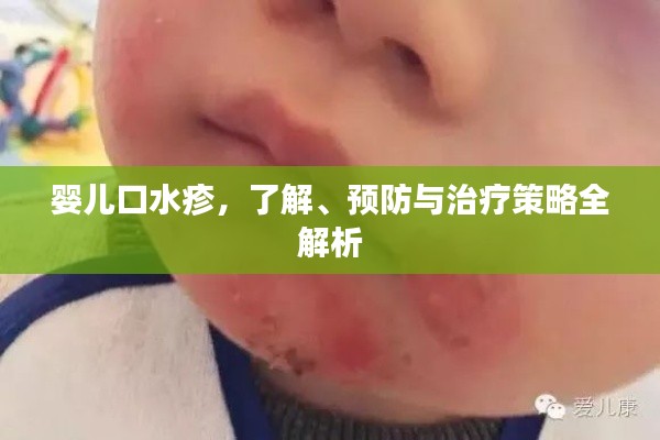 婴儿口水疹，了解、预防与治疗策略全解析