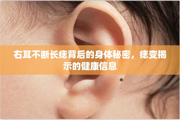 右耳不断长痣背后的身体秘密，痣变揭示的健康信息